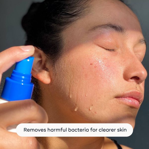 Magic Molecule Hypochlorous Acid Skin Spray