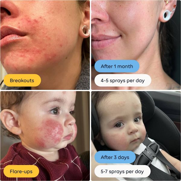 Magic Molecule Hypochlorous Acid Skin Spray